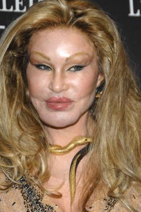 Geliftet-Jocelyn-Wildenstein-BM-Berlin-Los-Angeles.jpg