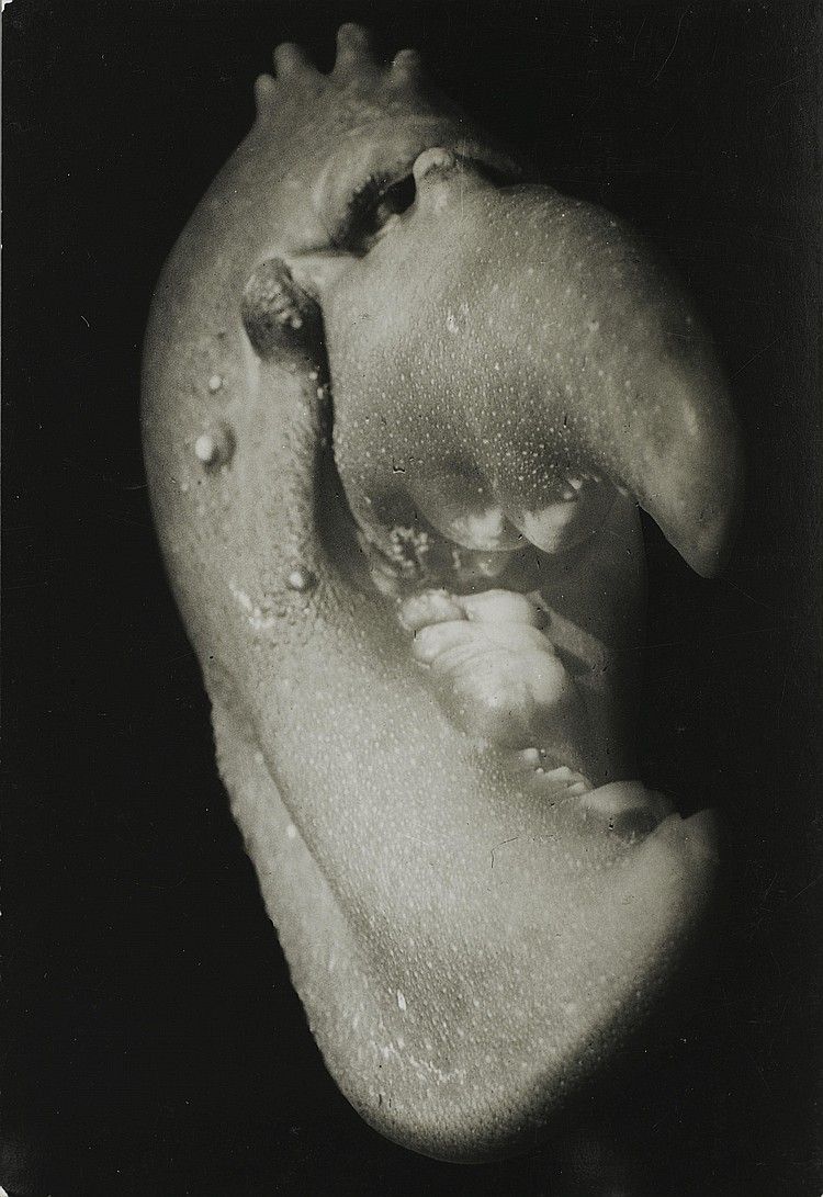 Jean Painleve, Pince de Homard (Lobster Claw), 1929.jpg