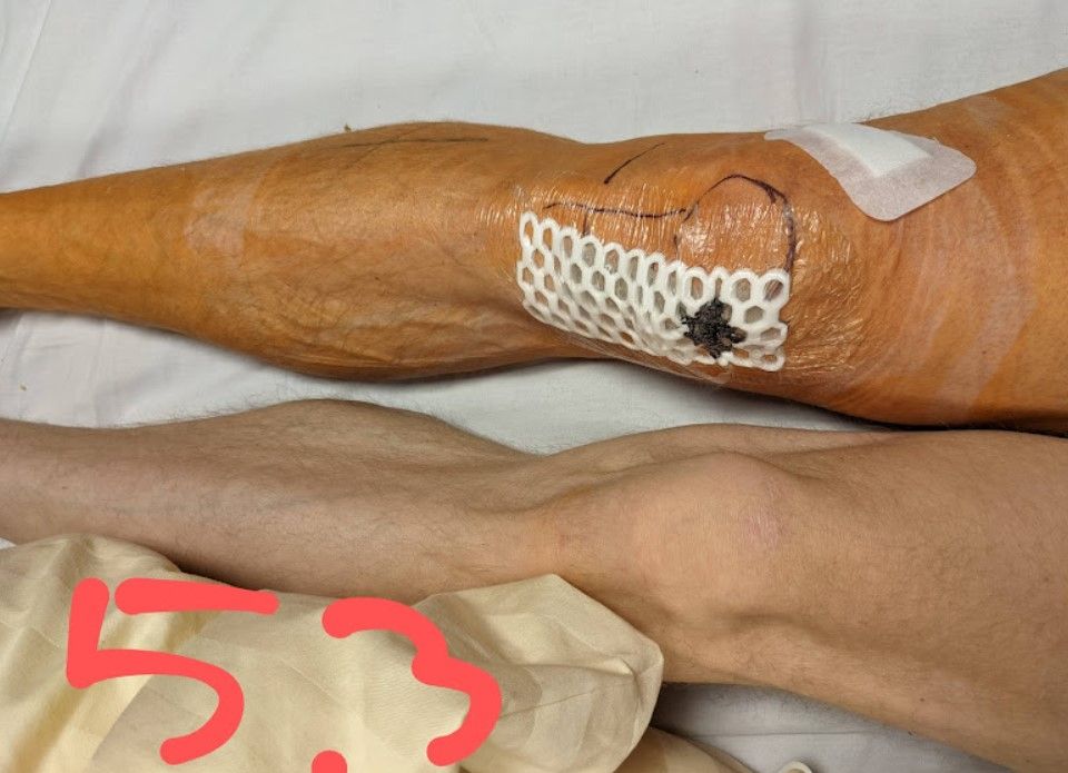 Knie0503.jpg