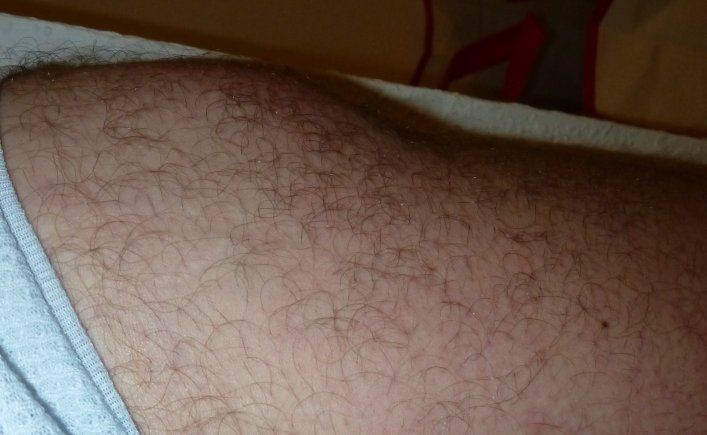 seitliche Ansicht Oberschenkel (Oberschenkelhals).jpg