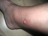 stich 003.JPG